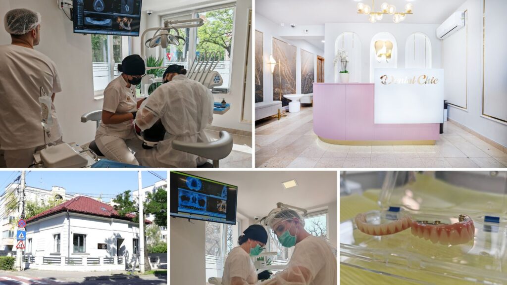 Afla etapele tratamentului cu implant dentar in Cluj Napoca, de la evaluare la coroana.